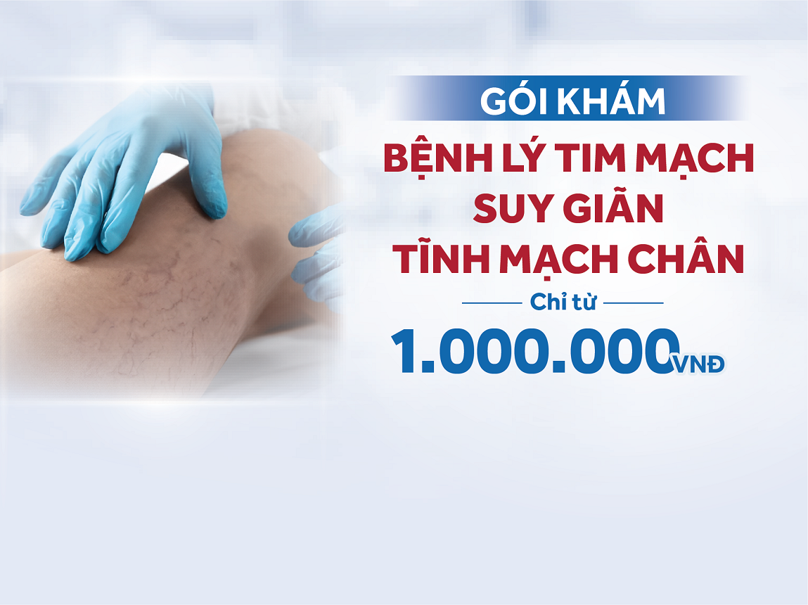 Gói khám Phòng ngừa bệnh lý tim mạch - suy giãn tĩnh mạch chân