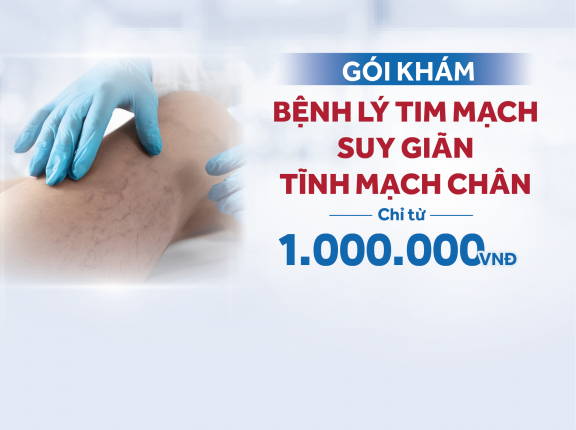 public://2025-05/Thumbnail__SUY GIÃN TĨNH MẠCH.png